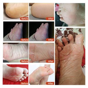 Foot-peel-mask-6